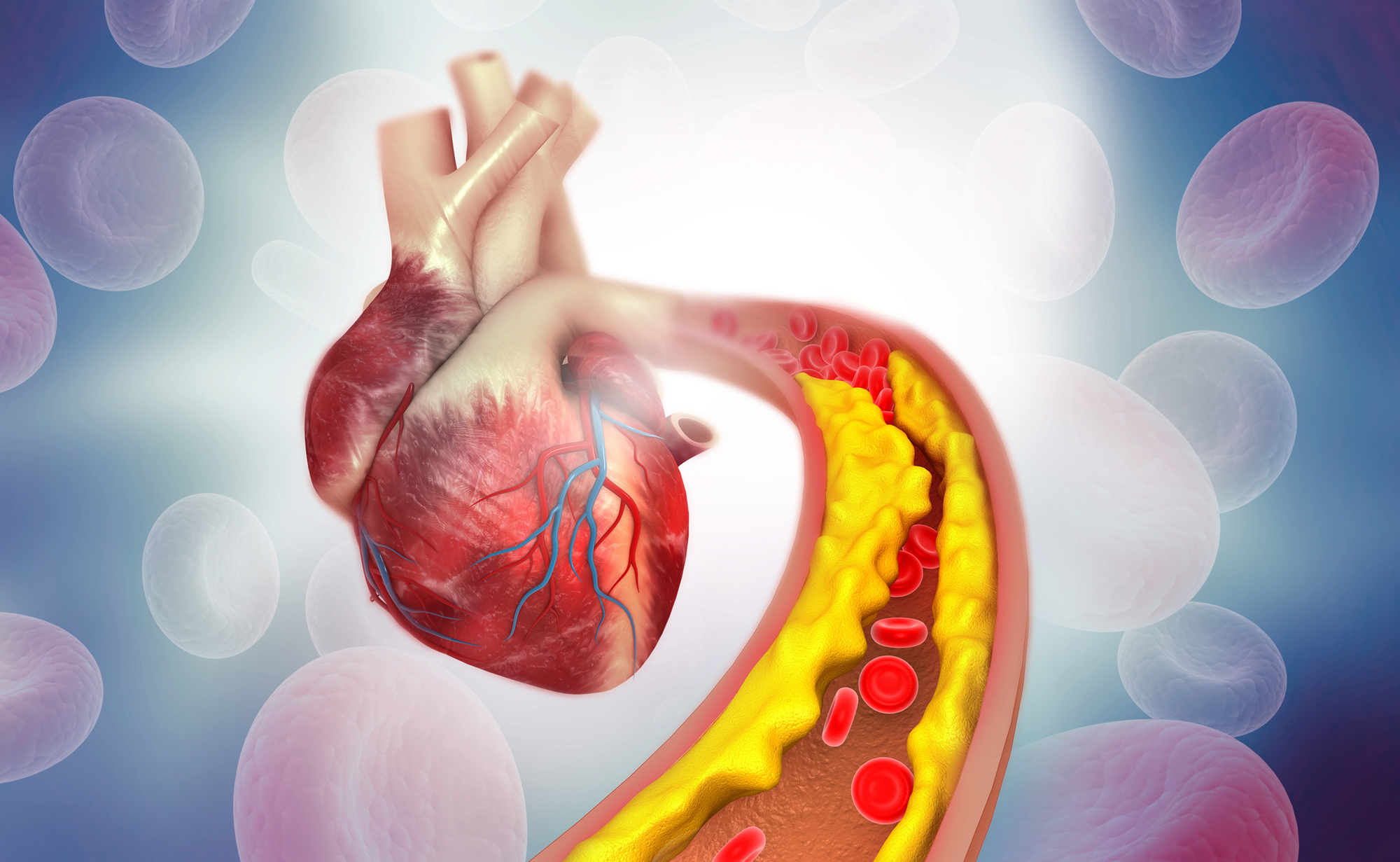 LDL-Cholesterin durch natürliche Mittel senken